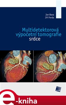 Obálka titulu Multidetektorová výpočetní tomografie srdce
